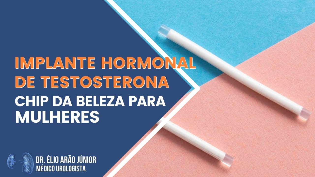 Implante hormonal de testosterona para mulheres Chip da Beleza Dr. Élio Arão Júnior YouTube