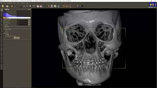 DDS-Pro 007 - DICOM filtering 3D objects generation