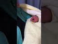 Recién nacido! En el hospital, llora por primera vez