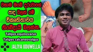 Newborn Baby Care Sinhala Tips | Foot deformity | දරුවාගේ විකෘතිතා | Leg problem in Child Sri Lanka screenshot 5