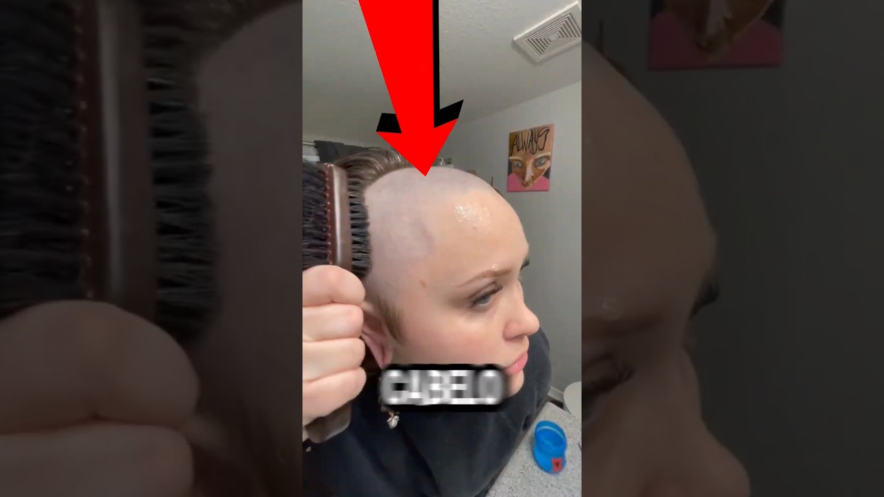 essa doença fez isso com o cabelo dela