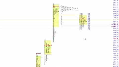 ShadowTrader Video Weekly 10.08.17 - Short term vs Long Term