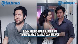 Kevin Aprilio Makin Keren Usai Transplantasi Rambut Dan Brewok