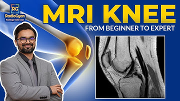 MRI Knee Mastery: From Basics to Expert Level 🎯 | Dr. Jassim Koya
