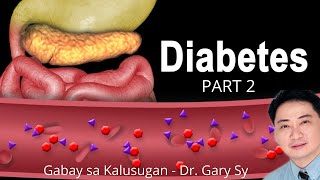 Diabetes Mellitus Part 2 - Dr. Gary Sy