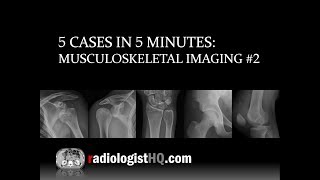 5 Cases in 5 Minutes: Musculoskeletal #2 screenshot 4