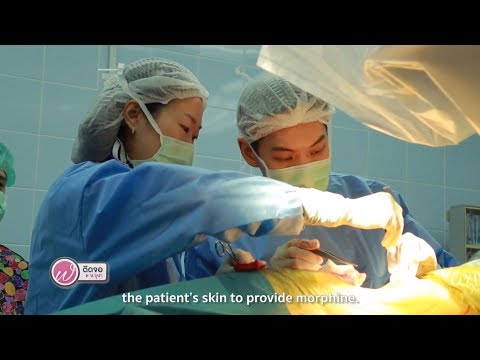 First Case First Station | การแก้ปวดมะเร็งขั้นสุดท้ายด้วยวิธีล่าสุด