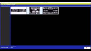 How to Compare X-rays Simultaneously | DentiMax Dental Imaging Software Tip