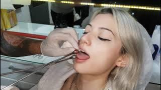Tongue - Dil - Piercing Delimi