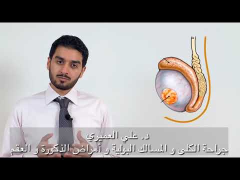 سرطان الخصية