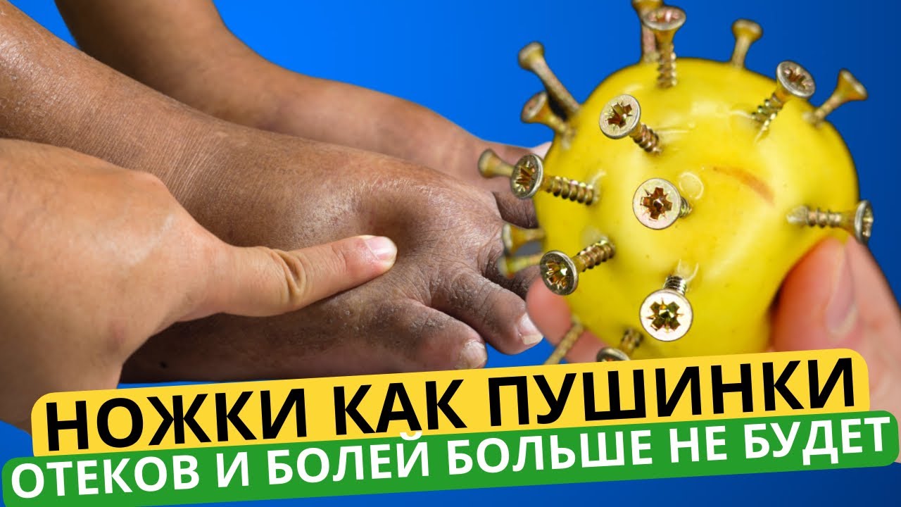 Ноги как пушинки и не болят! Кости, суставы, связки, сухожилия, боль в ...