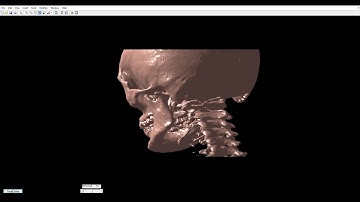 【MATLAB - 3D Reconstruction】Use DICOM files to reconstruct the whole skull