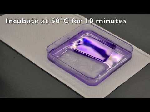 IEF-PAGE (Isoelectric-focusing Polyacrylamide Gel Electrophoresis)