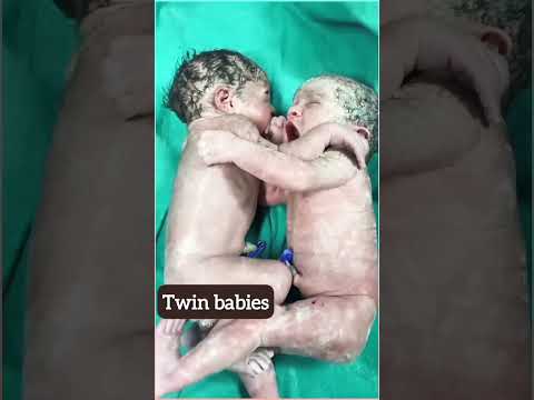 Twins babies first