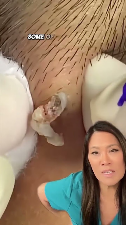 How strong are your squeeze muscles 🦀