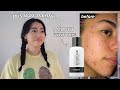 The Inkey List Glycolic Acid Toner *30 Day Results + Pictures*