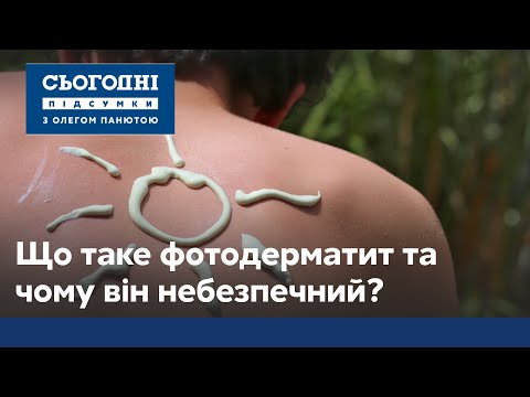 Что такое фотодерматит и почему он может возникнуть у каждого?