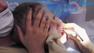 Осмотр у детского стоматолога в Волжском