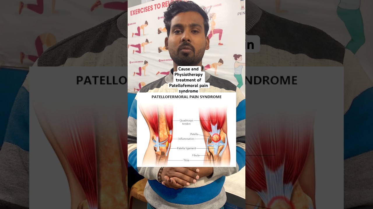 Patellofemoral pain syndrome physiotherapy treatment  