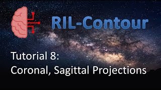 RIL-Contour Tutorial 8: Viewing axial, coronal, and sagittal projections