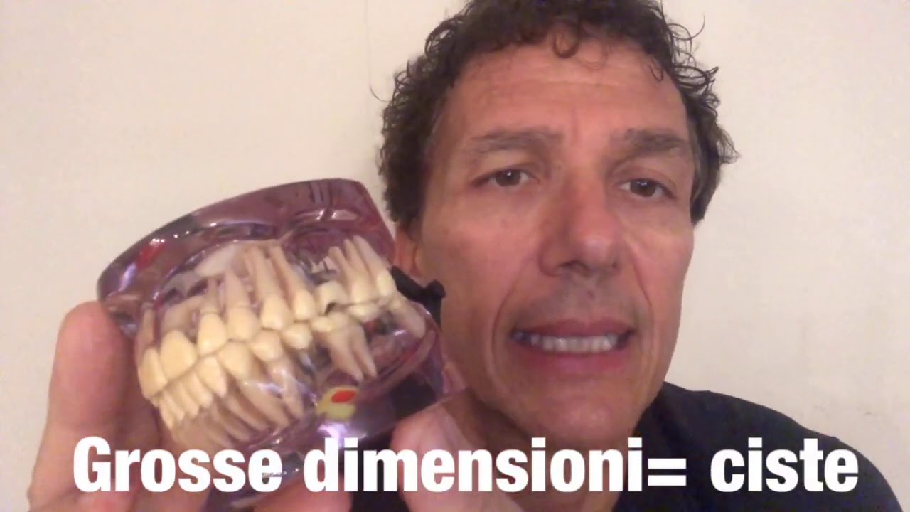 Cos'è il granuloma?