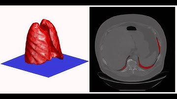 Lung Field Segmentation