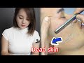 💈ASMR | Remove a lot of dead skin from men's face with an oriental razor. 🪒 Asian Wet Shave.