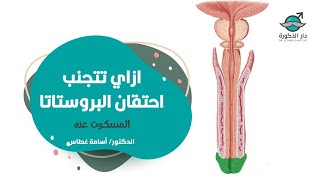 أزاي تتجنب إحتقان البروستاتا ؟! المسكوت عنه الدكتور أسامة غطاس