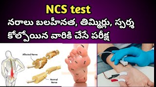 NCS Test ( Nerve Conduction Study) Procedure in Telugu