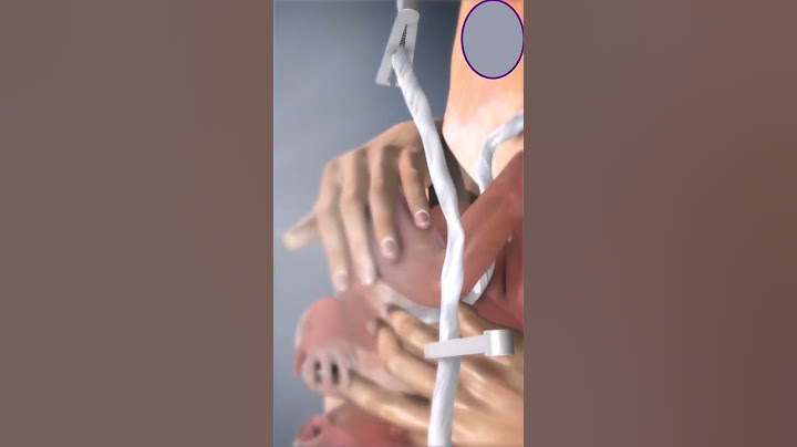 Placenta Removal Animation #shorts