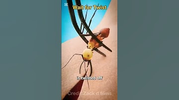 How to using A ant stitch Wounds😱 #shorts #facts #yutubeshorts #viralshorts