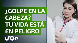 ¿Es cosa de risa? ¡Cuidado! Un golpe en la cabeza te puede costar la vida