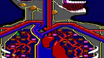 CGA 16 COLORS IBM PC Jr IBM PCjr IBM PC JUNIOR MICROSURGEON ~ LIFE AND DEATH MAME MESS 1983 INTERNAT