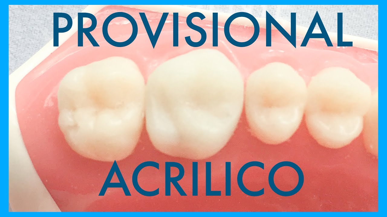 Provisional acrilico tallado con fresas hasta lograr anatomia. (Cuando