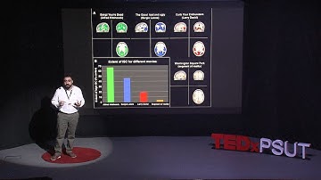 AI is not an adversary but rather an extension of the creative mind | Baha Hussein | TEDxPSUT