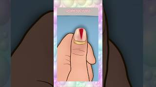 ASMR animation Finger piercing removal treatment #asmr #animation #shortsvideo #trending