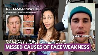 Ramsay Hunt Syndrome: The Facial Paralysis That's NOT Bell's Palsy — A Neurologist Explains