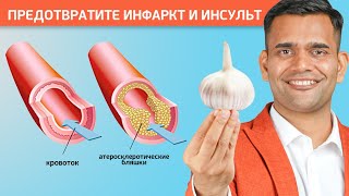 ИНФАРКТ И ИНСУЛЬТ. Профилактика.