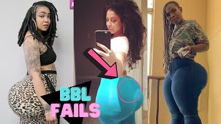 BBL Fails | Before & After Images are Shocking !!!