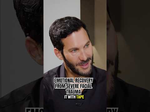 Video thumbnail: I Survived SEVERE Facial Trauma. [Emergency Rhinoplasty] #shorts