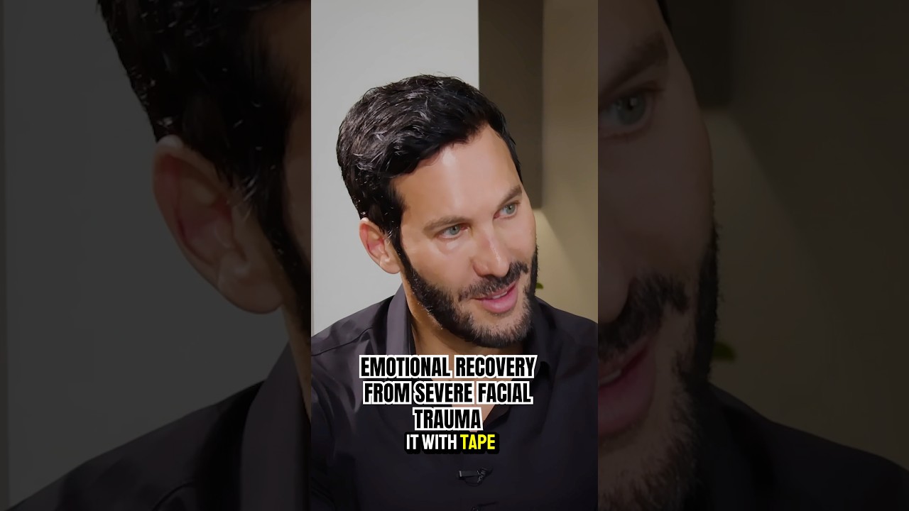 I Survived SEVERE Facial Trauma. [Emergency Rhinoplasty] 