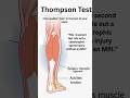 How to Spot a Ruptured Achilles (Thompson Test!) #shorts #physiotherapy #sportsinjury