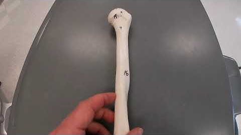 Bone Markings of the Humerus _Practice Quiz
