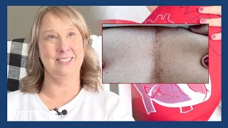 Mother who survived multiple heart attacks shares her story