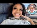 Getting Braces 😬 | Mini Vlog Update 💗