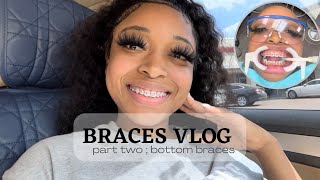 Getting Braces 😬 | Mini Vlog Update 💗