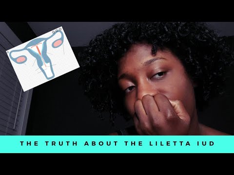 Hot girl hygiene series | the truth about THE LILETTA IUD | MIRENA V.S LILETTA IUD | 1 year review