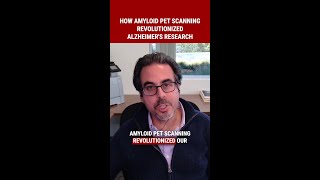 Amyloid Pet Scanning - Alzheimers Research