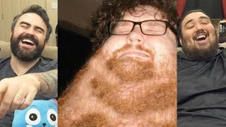 Glorious Power of Neck Beards