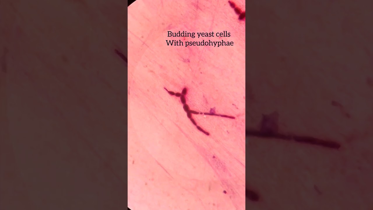 Budding yeast cells With pseudohyphae in gram stain 
